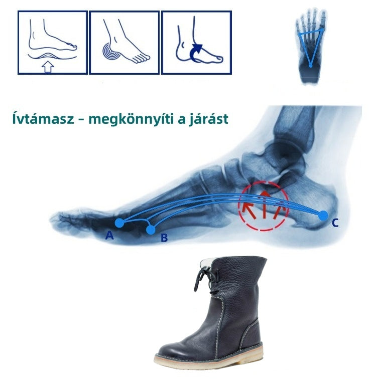 🎁[50% kedvezmény ma – ne hagyd ki] Ergonomikus kialakítású ortopéd cipő - kiváló minőségű bőr + téli gyapjú bélés + kézzel varrott 👞